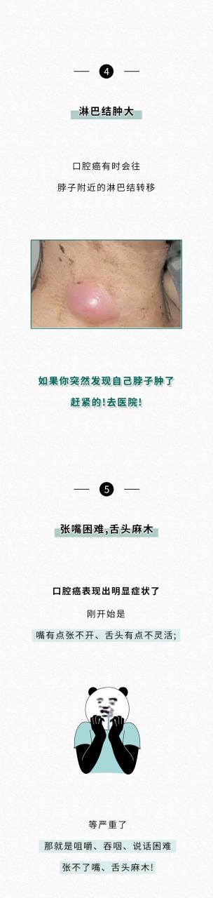 抽烟喝酒还嚼槟榔，到底TM死得有多快？